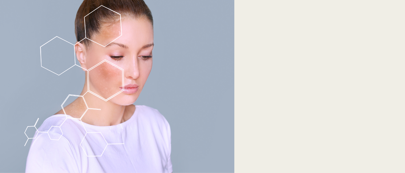 best dark spot cream