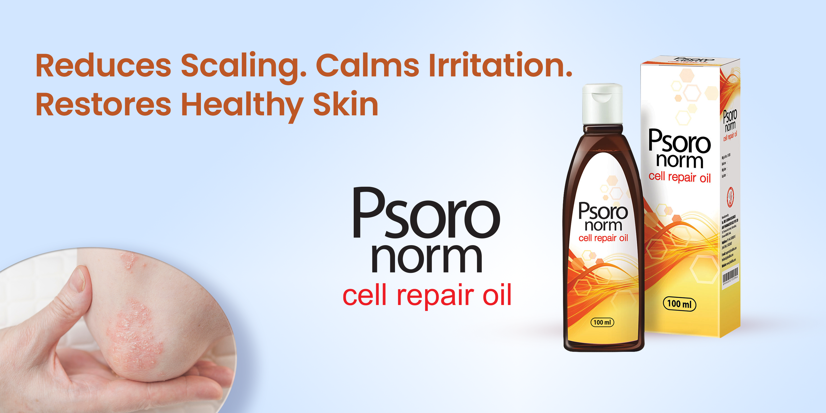 Psoronorm cell repair oil | psoriasis treatment oil