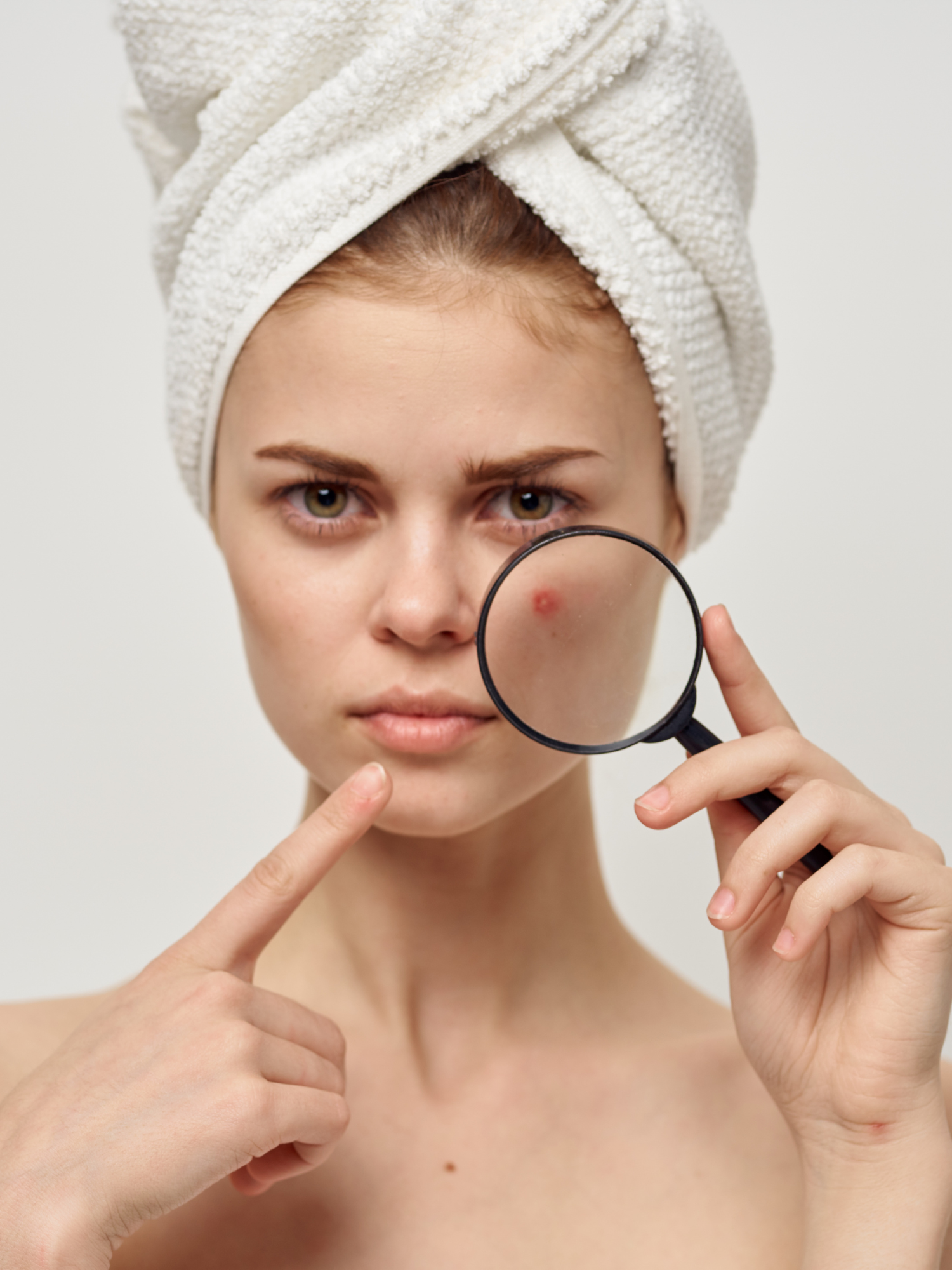 Anti-Acne Pack |anti acne pack | Verdura clear skin pack | Skin Treatment products