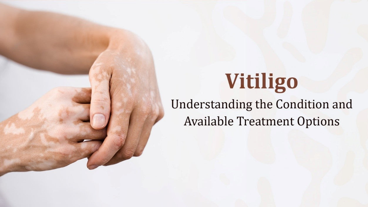 Vitiligo: Understanding the Condition and Available Treatment Options