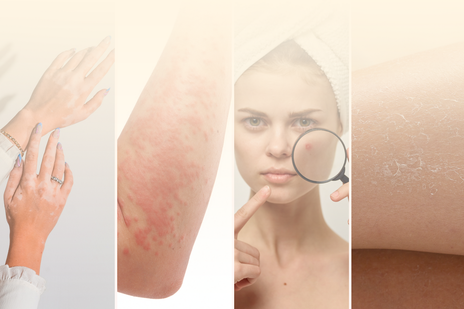 Indication based kits