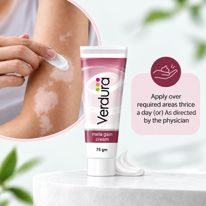How to use Verdura Mela Gain Cream - apply over required areas thrice a day or as directed by physician, cream applied on arm with visible depigmented patches