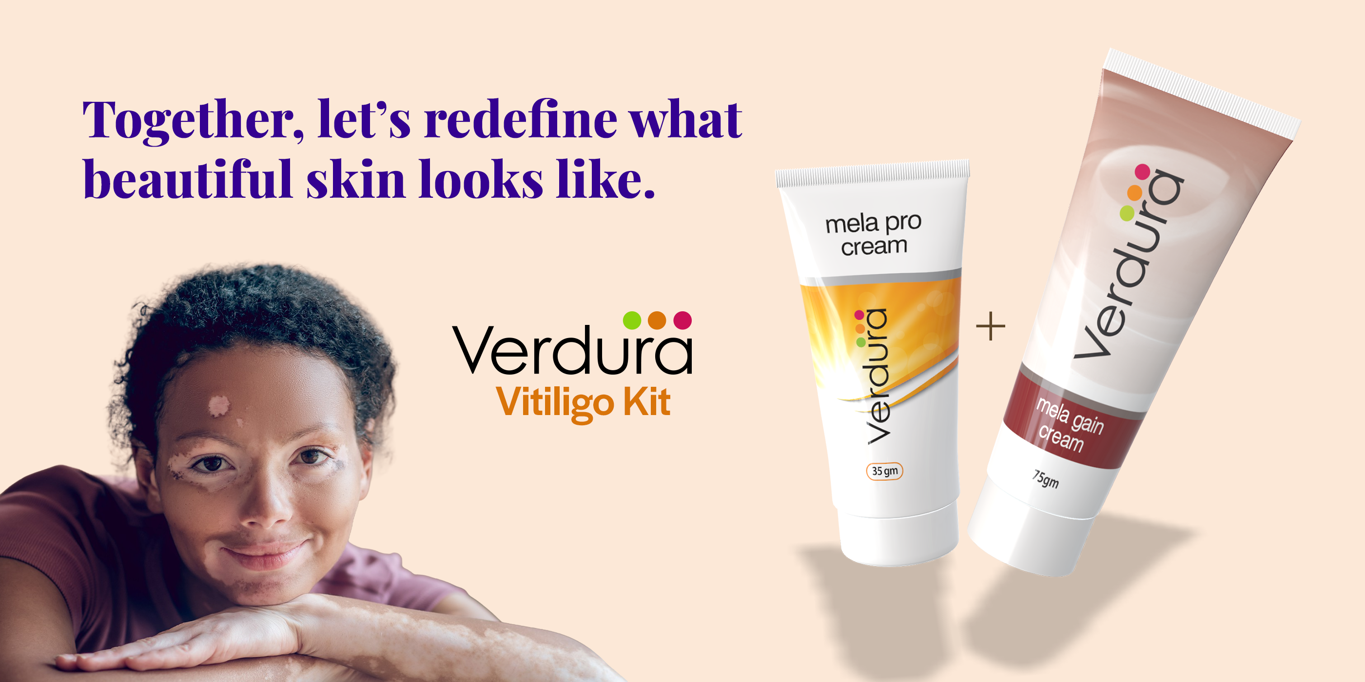cream for vitiligo, best vitiligo treatment cream 