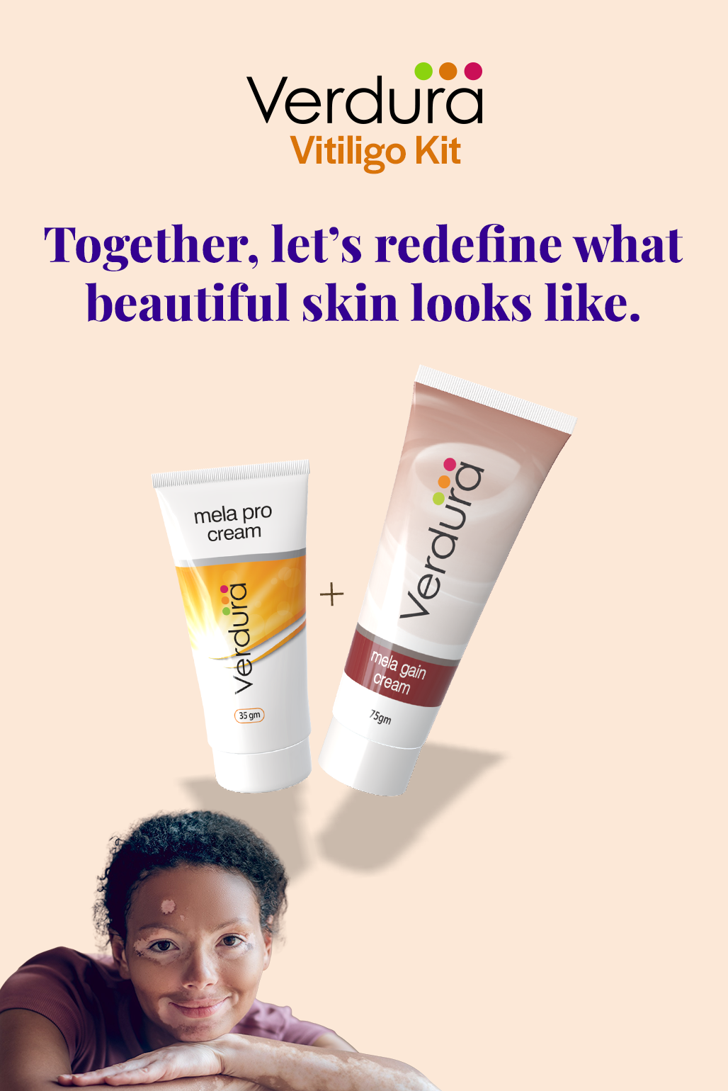 cream for vitiligo, best vitiligo treatment cream 