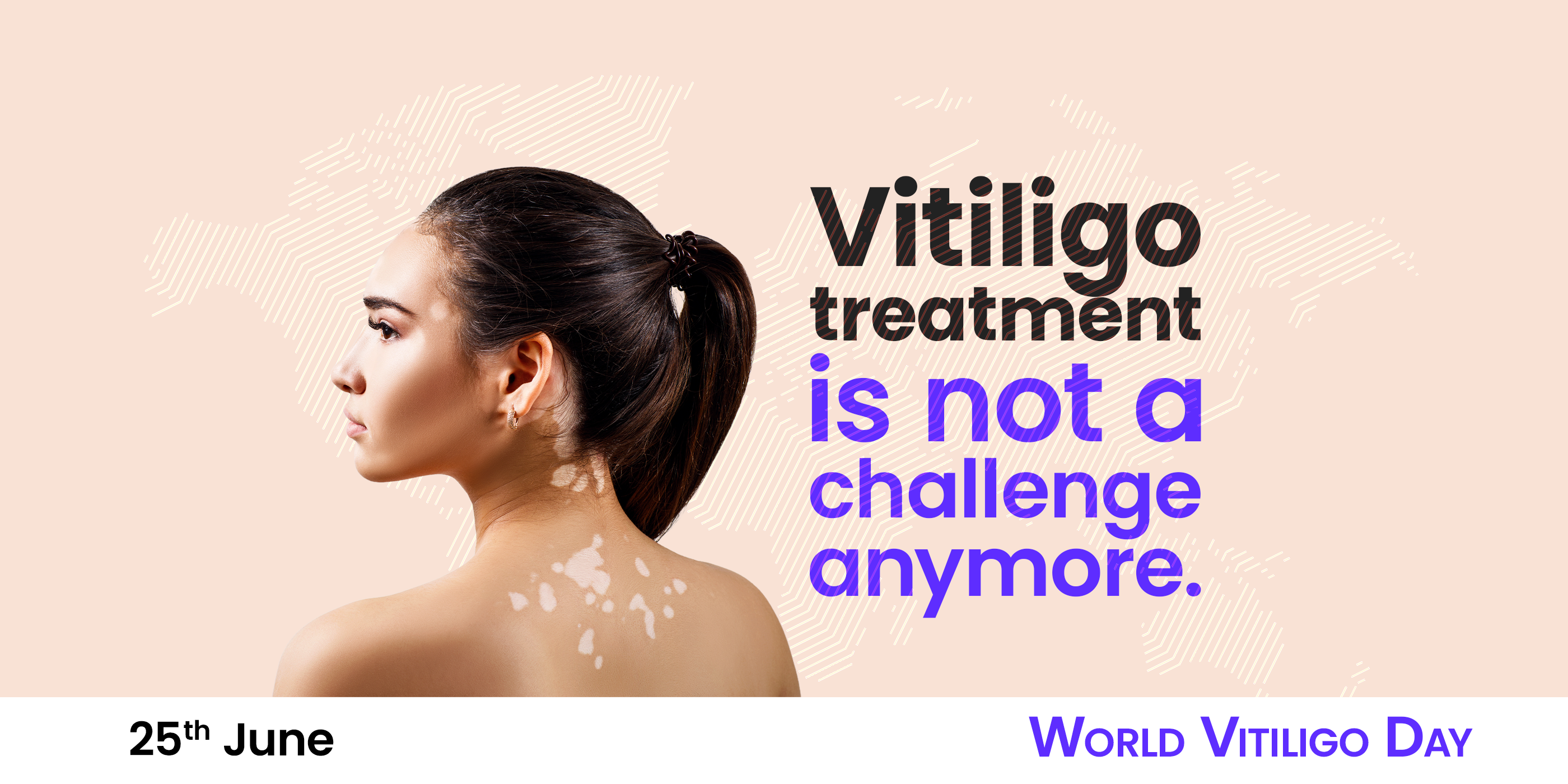 World vitiligo day awareness