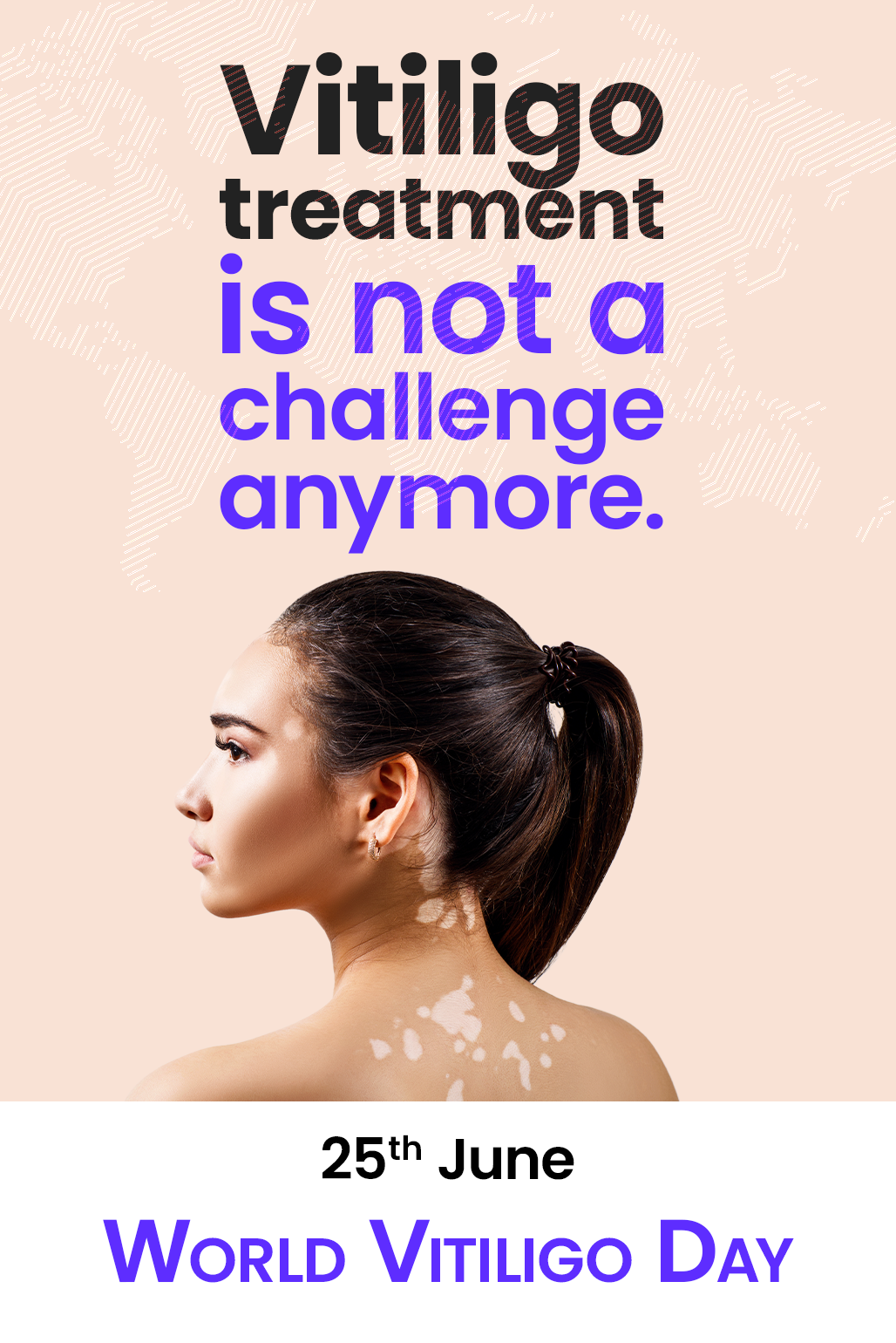 World vitiligo day awareness